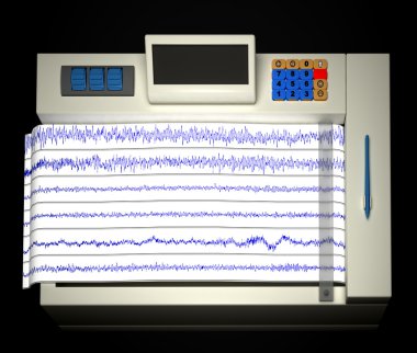 Encephalogram