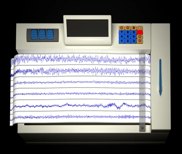 Encephalogram — Stok fotoğraf