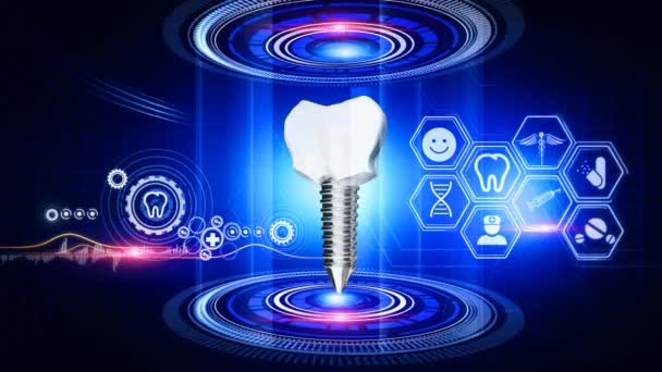 歯科インプラント 仮想現実周囲に医療アイコンを配置した回転歯科インプラントモデルを示す仮想現実3Dグラフィックス — ストック動画