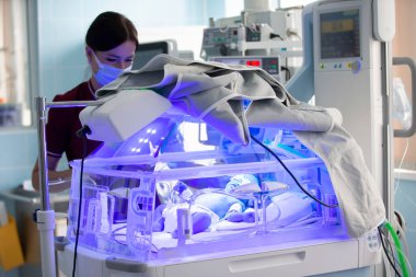 Beyaz Rusya, Gomil şehri, Haziran 01, 2021. Çocuk Hastanesi. Yeni doğmuş bir bebek kuluçka makinesinde ultraviyole ışık altında sarılık tedavisi görüyor..