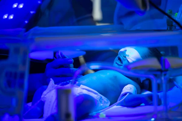 Nyfött Barn Som Får Behandling För Gulsot Ultraviolett Ljus Inkubatorn — Stockfoto