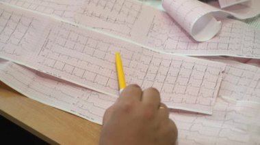 Doktorun elleri kardiyogramı inceliyor..