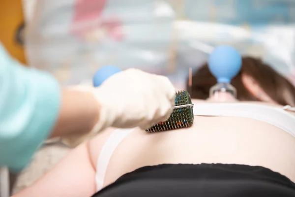 Doctor Makes Patient Acupuncture Vacuum Massage — Stockfoto