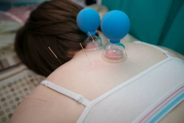 The doctor makes the patient acupuncture and vacuum massage.