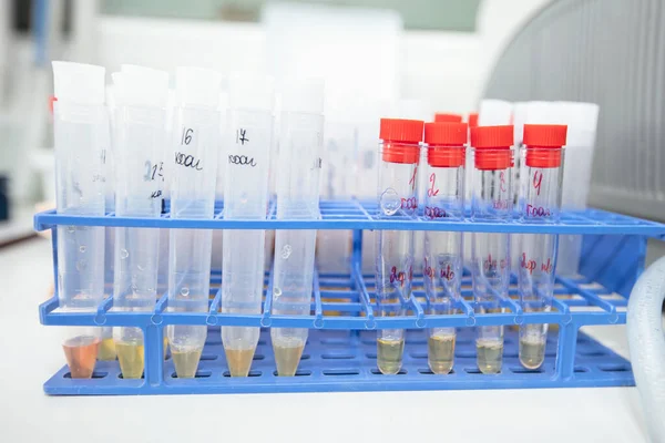Medical Test Tubes Urine Tests Biochemical Laboratory — 图库照片