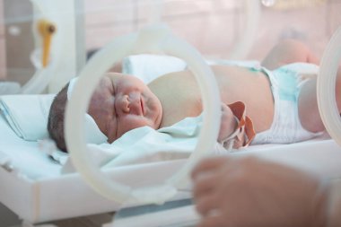 A newborn baby lies in boxes in the hospital. A child in an incubator. Neonatal and Premature Intensive Care Unit