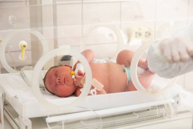 A newborn baby lies in boxes in the hospital. A child in an incubator. Neonatal and Premature Intensive Care Unit