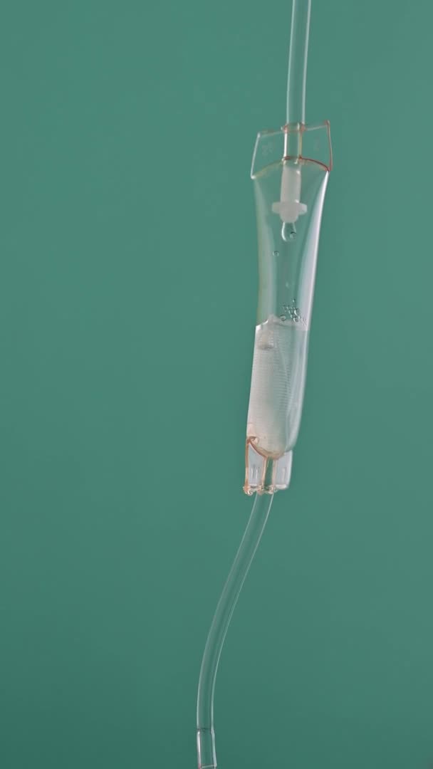 Nahaufnahme Intravenöser Tropfen Krankenhaus Intravenöse Kochsalzlösung Intravenöse Belastungsdosis — Stockvideo
