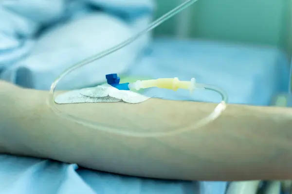 Closeup of arm with needle inserted into arm and tube attached to the needle. Blood Donation Process. The military hospital.