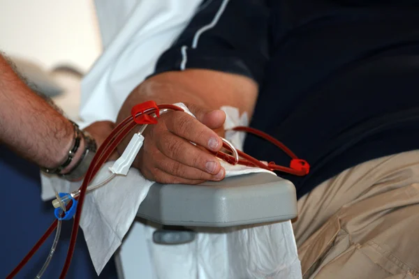 Diyaliz şant ile kol