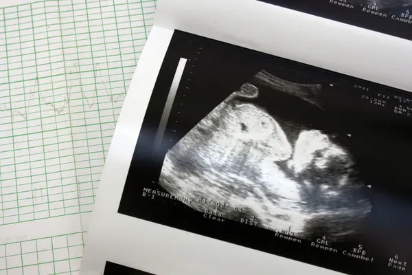 cariograph ve ultrason