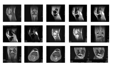 MRI images clipart