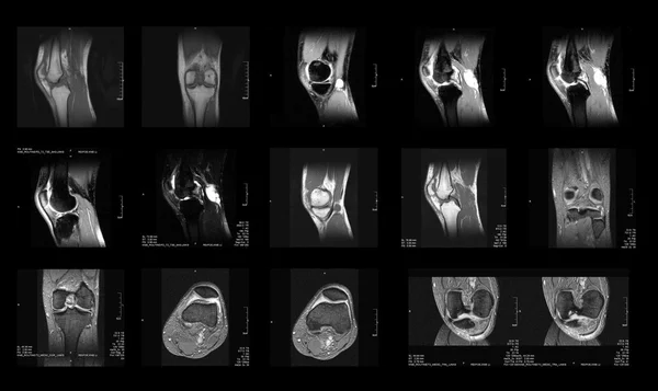 MRI 이미지 — 스톡 사진
