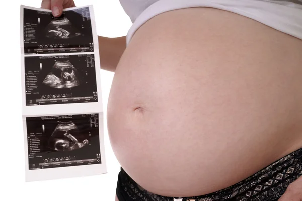 Pregnancy — Stock Image Pregnancy Stock Image