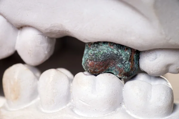 Teeth made of plaster — Stock Photo, Image