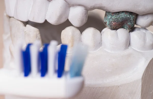 Teeth made of plaster — Stock Photo, Image