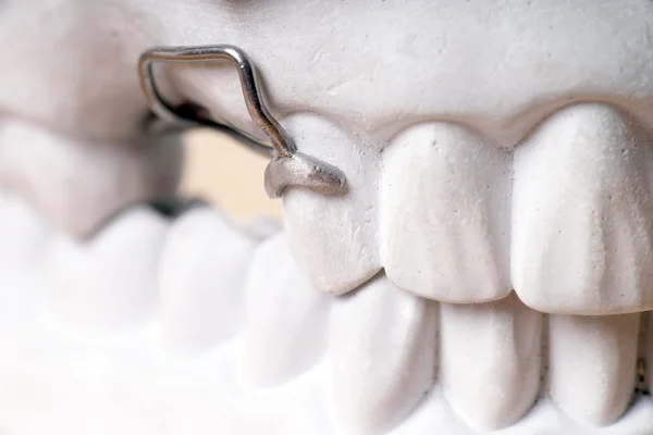 Prothèses dentaires — Photo