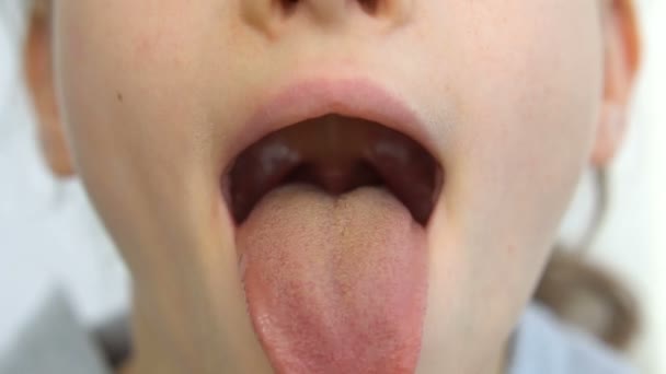 Weit geöffneter Mund mit herausgestreckter Zunge, Blick auf den Uvula und den weichen Gaumen eines kleinen Mädchens, Kinderzahnheilkunde — Stockvideo