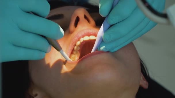 Stomatologist and patient at clinical office. A man dentist in a medical gloves works with a patient girl in a dental office. Healthcare and medicine concept. Dentistry — Vídeo de stock