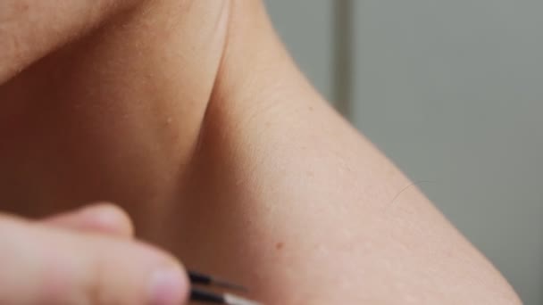 A nem kívánt szőrszálak eltávolítása — Stock videók