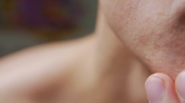 Yüz Cilt sorunları