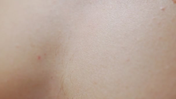 Csipeszek eltávolítása Body Hair Closeup — Stock videók