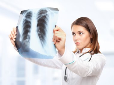 genç bir kadın doktor akciğer röntgeni resmine bakarak
