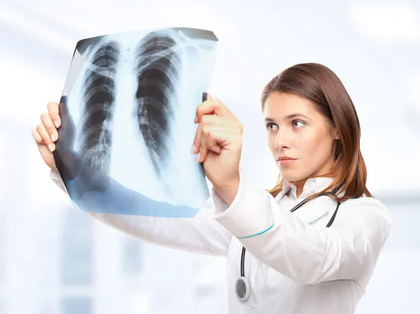 年轻的女医生看着肺部的 x 光照片 — 图库照片