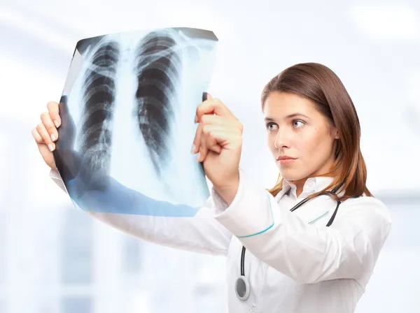 Doctora joven mirando la radiografía de los pulmones —  Fotos de Stock