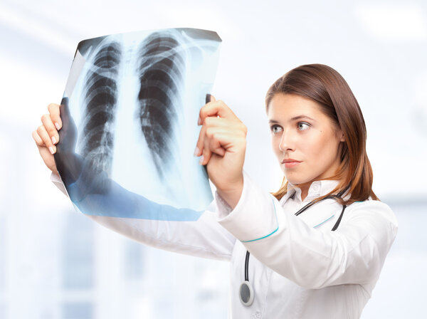 Young female doctor looking at the x-ray picture of lungs