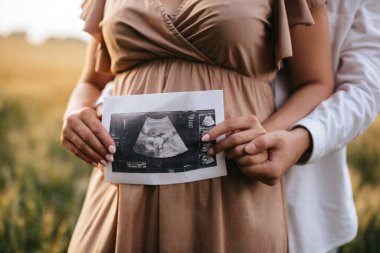 Kocasıyla hamile bir kadın ultrason bebek görüntüsü taşıyor. Anne ve babanın ellerinde hamile bir karnının arka planında ultrason görüntüsünün yakın plan fotoğrafı. Hamilelik kavramı. 