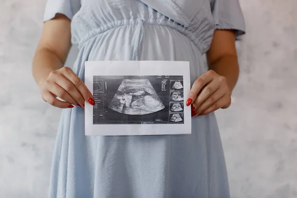 Pregnant Woman Holds Ultrasound Baby Image Close Photo Ultrasound Image — Fotografia de Stock