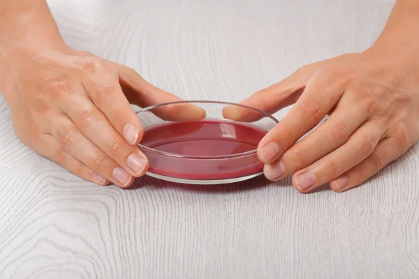 Blood in petri dishes — Stock Photo, Image