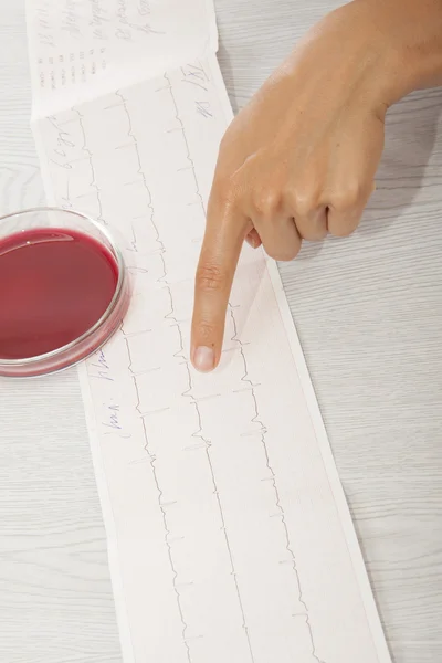 Doctor analyzing electrocardiogram — Stock Photo, Image