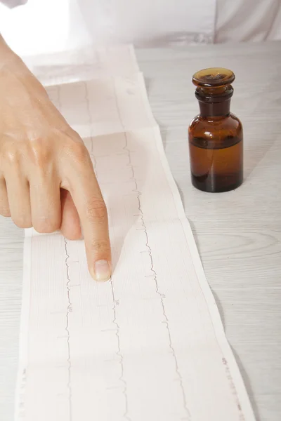 Doctor analyzing electrocardiogram — Stock Photo, Image