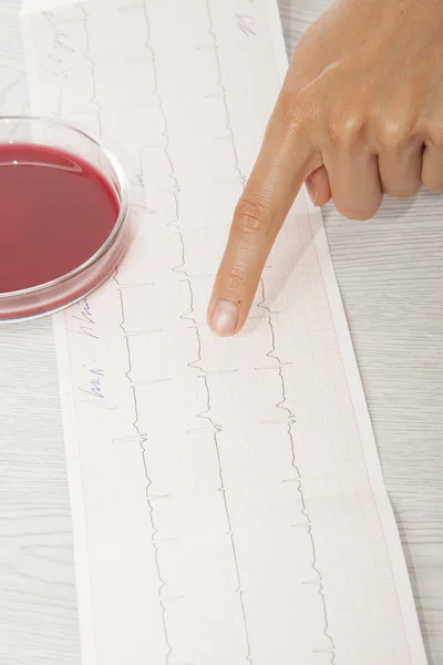 Doctor analyzing electrocardiogram — Stock Photo, Image