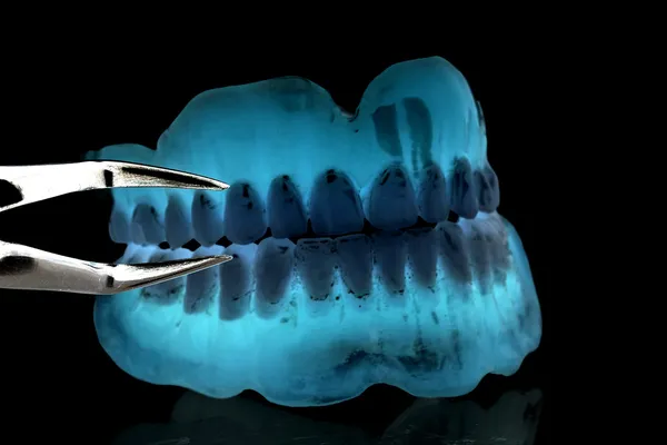 ACRYLIC DENTURE - FULL FRONT SET with a tool — стоковое фото