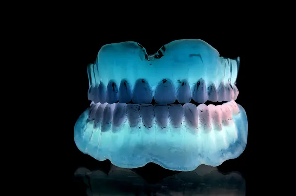 ACRYLIC DENTURE- FULL FRONT SET — Stock Photo, Image