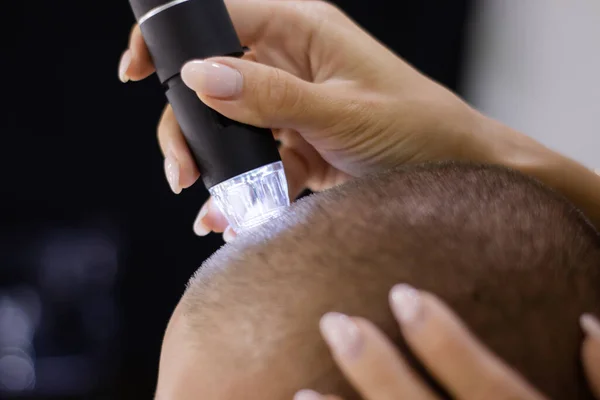 Trichoscope Examination Hair Scalp Hair Follicles Young Man Copy Space — Stockfoto