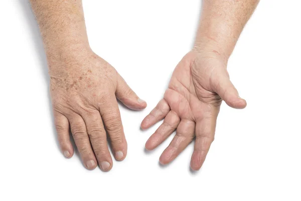 Senior hands — Stock Photo, Image