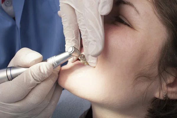 Dental Cleaning Close-up — Stock Photo, Image