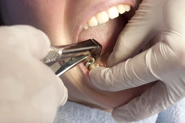 Zahnarzt — Stockfoto