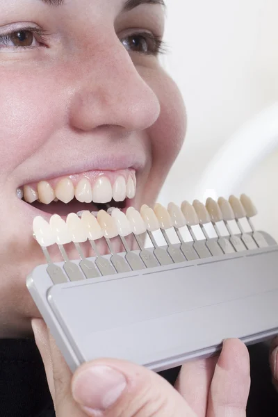 Tandarts kies wit van tanden — Stockfoto