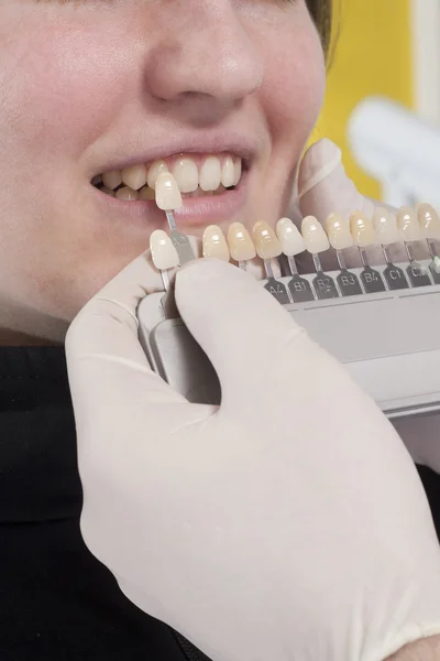 Dentista escolher branco dos dentes — Fotografia de Stock