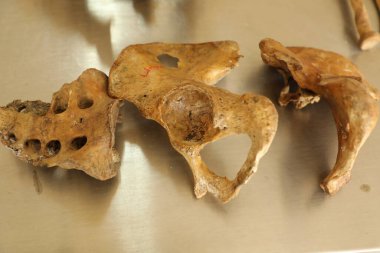 Hastanedeki İnsan Anatomisi Laboratuarı