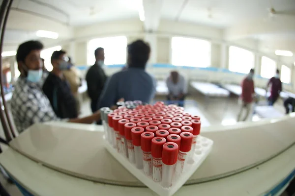 Medische Tubes Voor Bloedonderzoek Hospital — Stockfoto