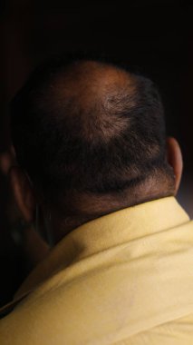 Kel kafalı adamın arkadan görünüşü