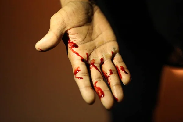 Mão Masculina Com Sangue — Fotografia de Stock
