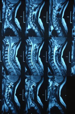 Hastanede MRI Tarayıcı Ekipmanı