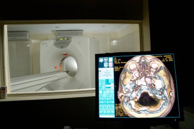 Hastanede MRI Tarayıcı Ekipmanı